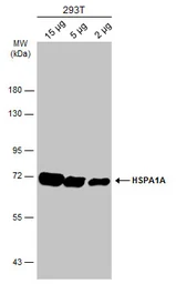 Anti-Hsp70 antibody used in Western Blot (WB). GTX111088