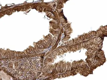Anti-alpha 1 Catenin antibody [N3C2], Internal used in IHC (Paraffin sections) (IHC-P). GTX111095