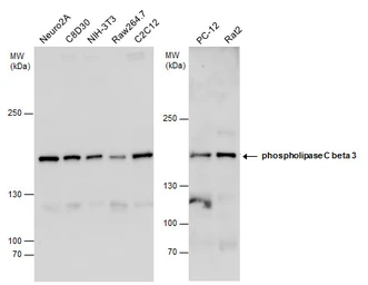 Anti-PLCB3 antibody used in Western Blot (WB). GTX111100