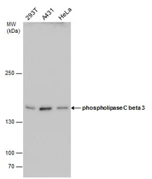 Anti-PLCB3 antibody used in Western Blot (WB). GTX111100