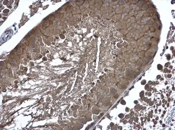 Anti-Cyclin B2 antibody used in IHC (Paraffin sections) (IHC-P). GTX111118