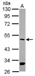Anti-MEK5 antibody [N1N3] used in Western Blot (WB). GTX111129