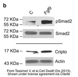 Anti-SMAD2 antibody used in Western Blot (WB). GTX111131