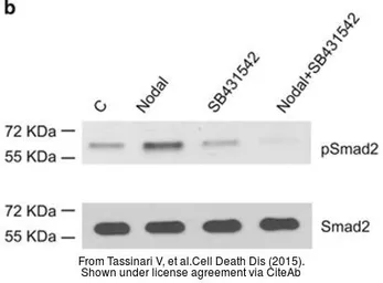 Anti-SMAD2 antibody used in Western Blot (WB). GTX111131