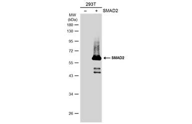 Anti-SMAD2 antibody used in Western Blot (WB). GTX111131