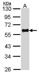 Anti-SMAD2 antibody used in Western Blot (WB). GTX111131