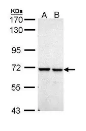 Anti-PPIL2 antibody [N1C1] used in Western Blot (WB). GTX111142