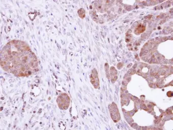 Anti-HSC70 antibody [C1C3] used in IHC (Paraffin sections) (IHC-P). GTX111150