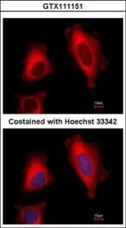 Anti-EEF1D antibody used in Immunocytochemistry/ Immunofluorescence (ICC/IF). GTX111151