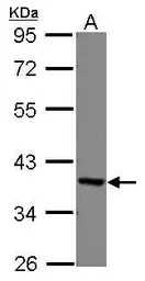 Anti-EEF1D antibody used in Western Blot (WB). GTX111151