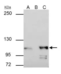 Anti-alpha Catenin antibody [N1N3] used in Immunoprecipitation (IP). GTX111168