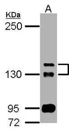Anti-TAOK2 antibody [N1N2-2], N-term used in Western Blot (WB). GTX111171