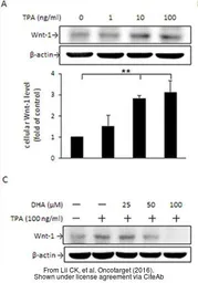 Anti-Wnt1 antibody used in Western Blot (WB). GTX111182