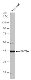 Anti-Wnt5a antibody used in Western Blot (WB). GTX111187