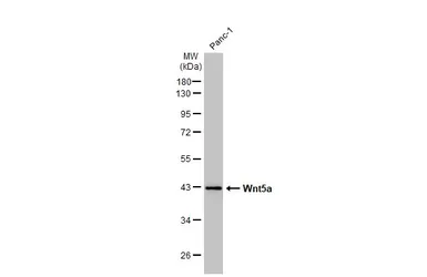 Anti-Wnt5a antibody used in Western Blot (WB). GTX111187