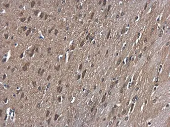 Anti-GSK3 beta antibody [C1C3] used in IHC (Paraffin sections) (IHC-P). GTX111192