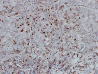 Anti-GSK3 beta antibody [C1C3] used in IHC (Paraffin sections) (IHC-P). GTX111192