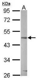 Anti-GSK3 beta antibody [C1C3] used in Western Blot (WB). GTX111192