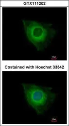 Anti-XIAP antibody used in Immunocytochemistry/ Immunofluorescence (ICC/IF). GTX111202