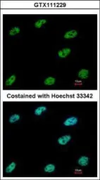Anti-CtBP1 antibody [N2C2], Internal used in Immunocytochemistry/ Immunofluorescence (ICC/IF). GTX111229