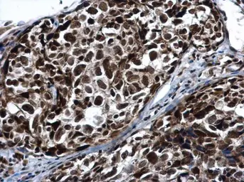 Anti-PRP19 antibody [N2C2], Internal used in IHC (Paraffin sections) (IHC-P). GTX111233
