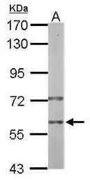Anti-PRP19 antibody [N2C2], Internal used in Western Blot (WB). GTX111233