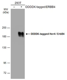 Anti-Her4 / ErbB4 antibody [C1C3] used in Western Blot (WB). GTX111276