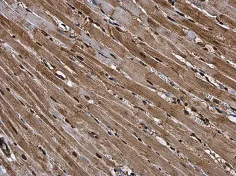 Anti-RUVBL1 antibody used in IHC (Paraffin sections) (IHC-P). GTX111294