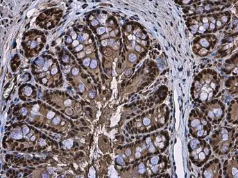 Anti-RUVBL1 antibody used in IHC (Paraffin sections) (IHC-P). GTX111294