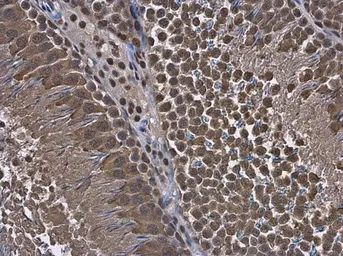Anti-RUVBL1 antibody used in IHC (Paraffin sections) (IHC-P). GTX111294