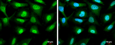 Anti-RUVBL1 antibody used in Immunocytochemistry/ Immunofluorescence (ICC/IF). GTX111294