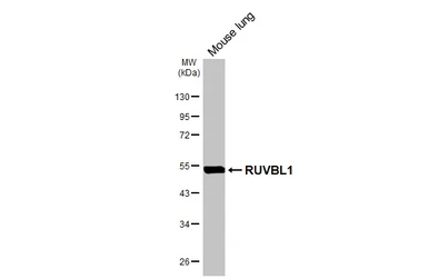 Anti-RUVBL1 antibody used in Western Blot (WB). GTX111294