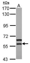 Anti-MATK antibody [N3C3] used in Western Blot (WB). GTX111326