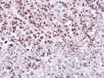 Anti-WEE1 antibody [N3C2], Internal used in IHC (Paraffin sections) (IHC-P). GTX111392