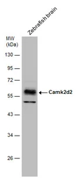 Anti-CaMKII delta antibody used in Western Blot (WB). GTX111401