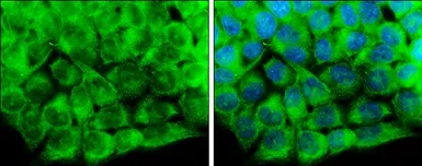 Anti-CaMKII delta antibody used in Immunocytochemistry/ Immunofluorescence (ICC/IF). GTX111401