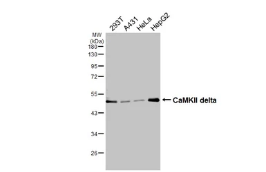 Anti-CaMKII delta antibody used in Western Blot (WB). GTX111401