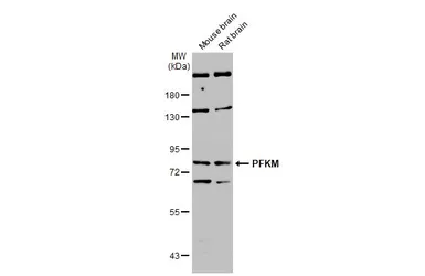 Anti-PFKM antibody [N1N2-2], N-term used in Western Blot (WB). GTX111461