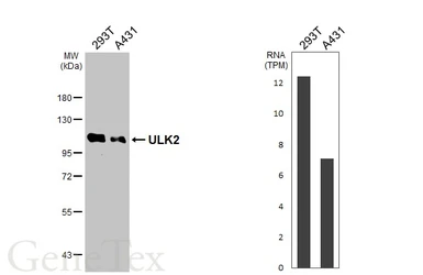 Anti-ULK2 antibody [C2C3], C-term used in Western Blot (WB). GTX111476