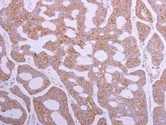 Anti-TRIP6 antibody [N3C3] used in IHC (Paraffin sections) (IHC-P). GTX111504