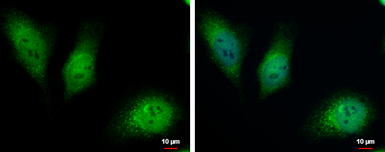 Anti-HKDC1 antibody used in Immunocytochemistry/ Immunofluorescence (ICC/IF). GTX111506