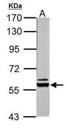 Anti-Pyruvate Kinase (liver/RBC) antibody used in Western Blot (WB). GTX111536