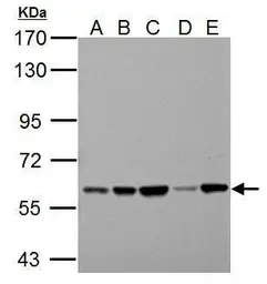 Anti-Pyruvate Kinase (liver/RBC) antibody used in Western Blot (WB). GTX111536