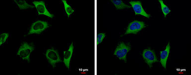 Anti-Pyruvate Kinase (liver/RBC) antibody used in Immunocytochemistry/ Immunofluorescence (ICC/IF). GTX111536
