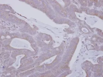 Anti-Mark3 antibody used in IHC (Paraffin sections) (IHC-P). GTX111538