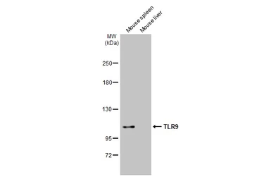Anti-TLR9 antibody [N1N2], N-term used in Western Blot (WB). GTX111547