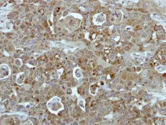 Anti-Bcr antibody [C2C3-2], C-term used in IHC (Paraffin sections) (IHC-P). GTX111591