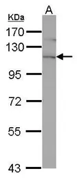 Anti-EphA4 antibody [N3C2-2], Internal used in Western Blot (WB). GTX111602