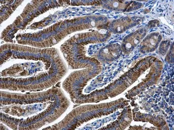 Anti-CKMT2 antibody [N2C3] used in IHC (Paraffin sections) (IHC-P). GTX111620