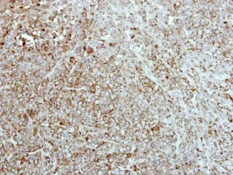 Anti-CKMT2 antibody [N2C3] used in IHC (Paraffin sections) (IHC-P). GTX111620